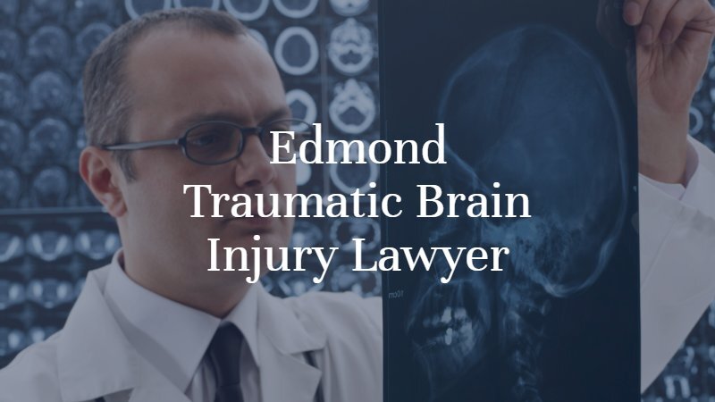Edmond Traumatic Brain Injury Lawyer