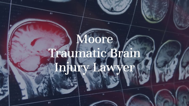 Moore Traumatic Brain Injury Lawyer | Dan Davis Law